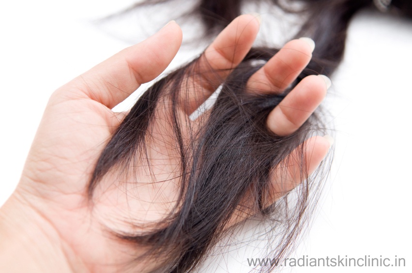 hair fall treatment by best doctor in jaipur Archives - Radiant Skin  Clinic- Laser Hair Removal & Dermatologist in Jaipur