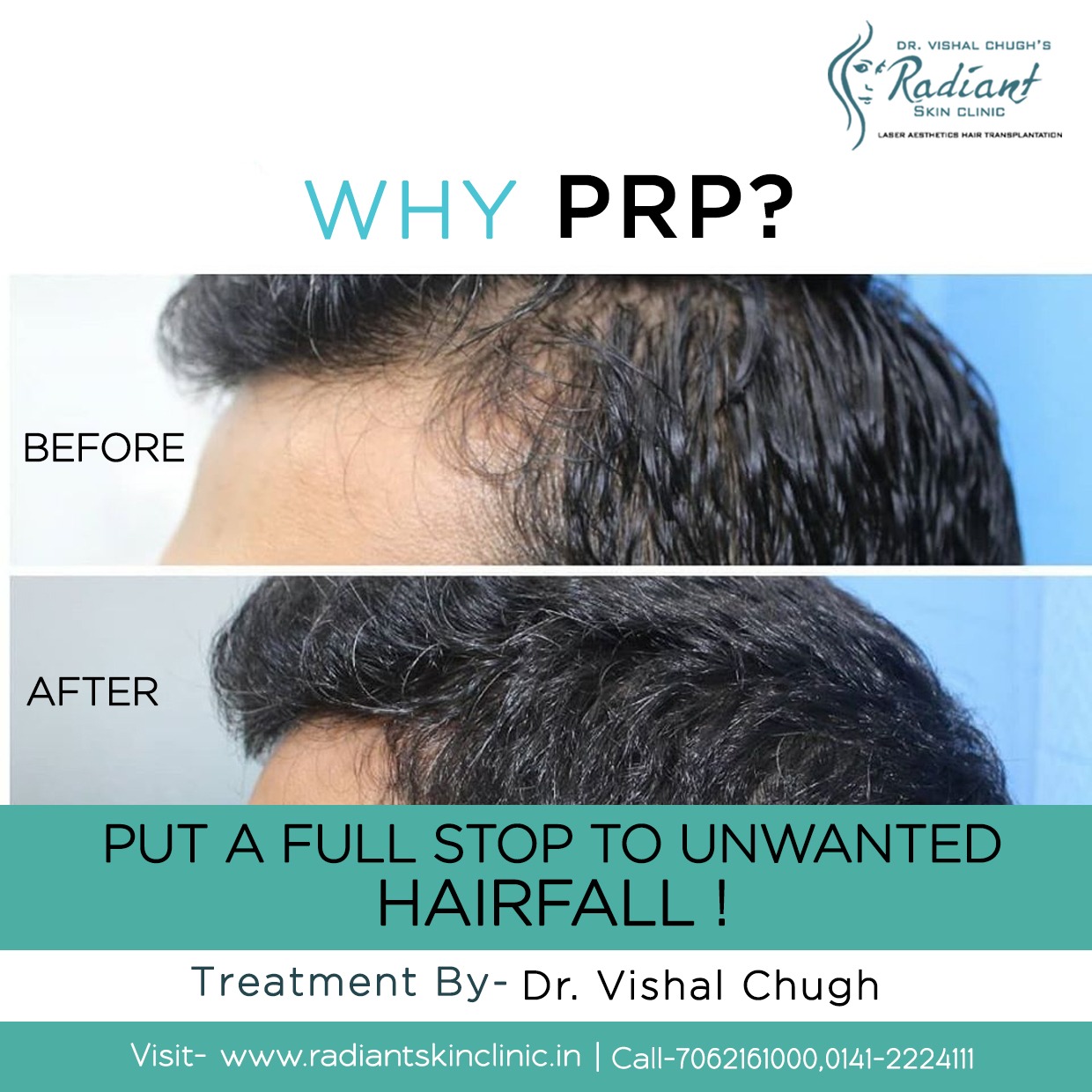 best doctor for hair fall treatment in civil lines jaipur, Rajasthan best doctor for hair fall treatment in civil lines jaipur, Rajasthan