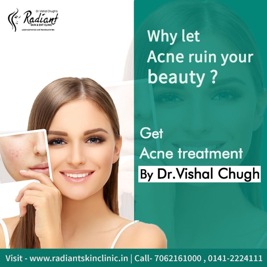 acne doctor in jaipur