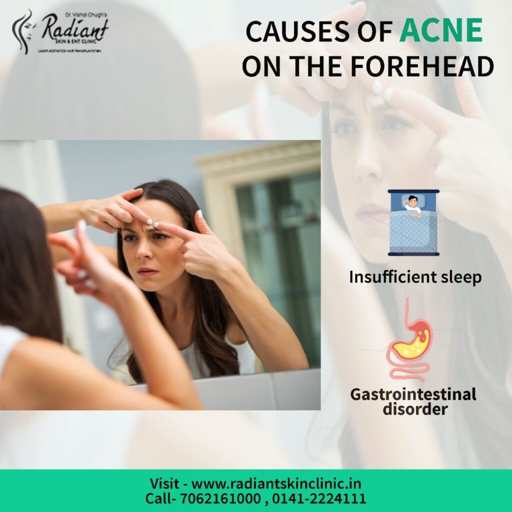 top 5 acne doctor in jaipur