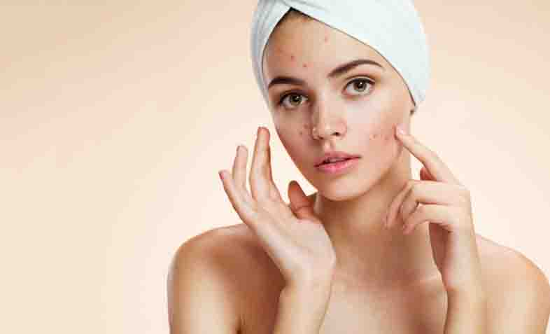 acne doctor in jaipur best acne doctor in jaipur top 5 acne doctor in jaipur treatment of acne in jaipur acne treatment in jaipur