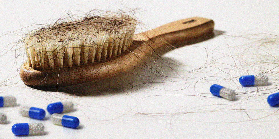 best hair transplant treatment in jaipur