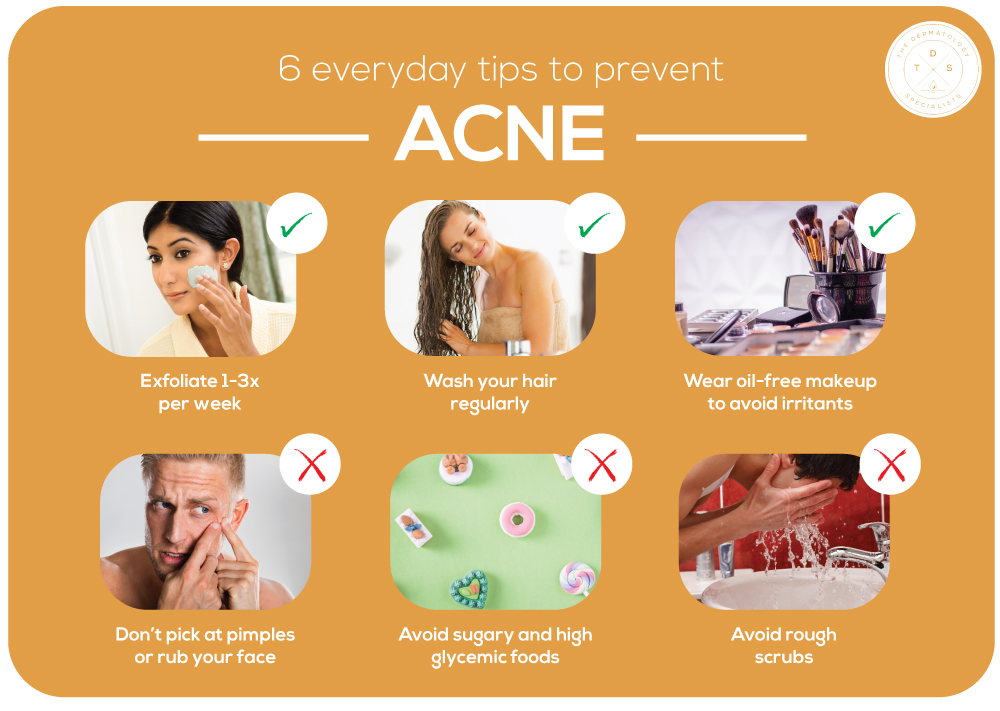 Acne Treatment in Jaipur