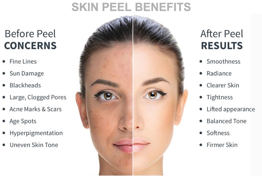 Best Chemical Pell Treatment in Jaipur by Dr. Vishal Chugh