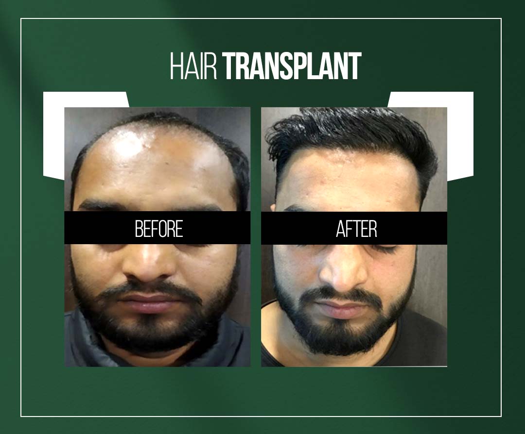 Dr. Vishal Chugh, Best Dermatologist, & Skin Specialist in Jaipur Dr. Vishal Chugh, Best Dermatologist, & Skin Specialist in Jaipur