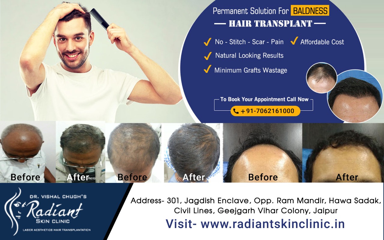 Best Hair Treatment In Jaipur