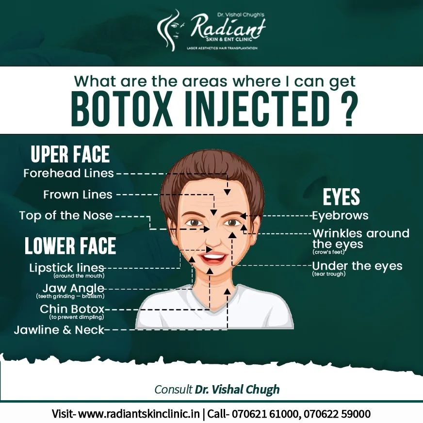 Botox and fillers anti-ageing treatment in Jaipur