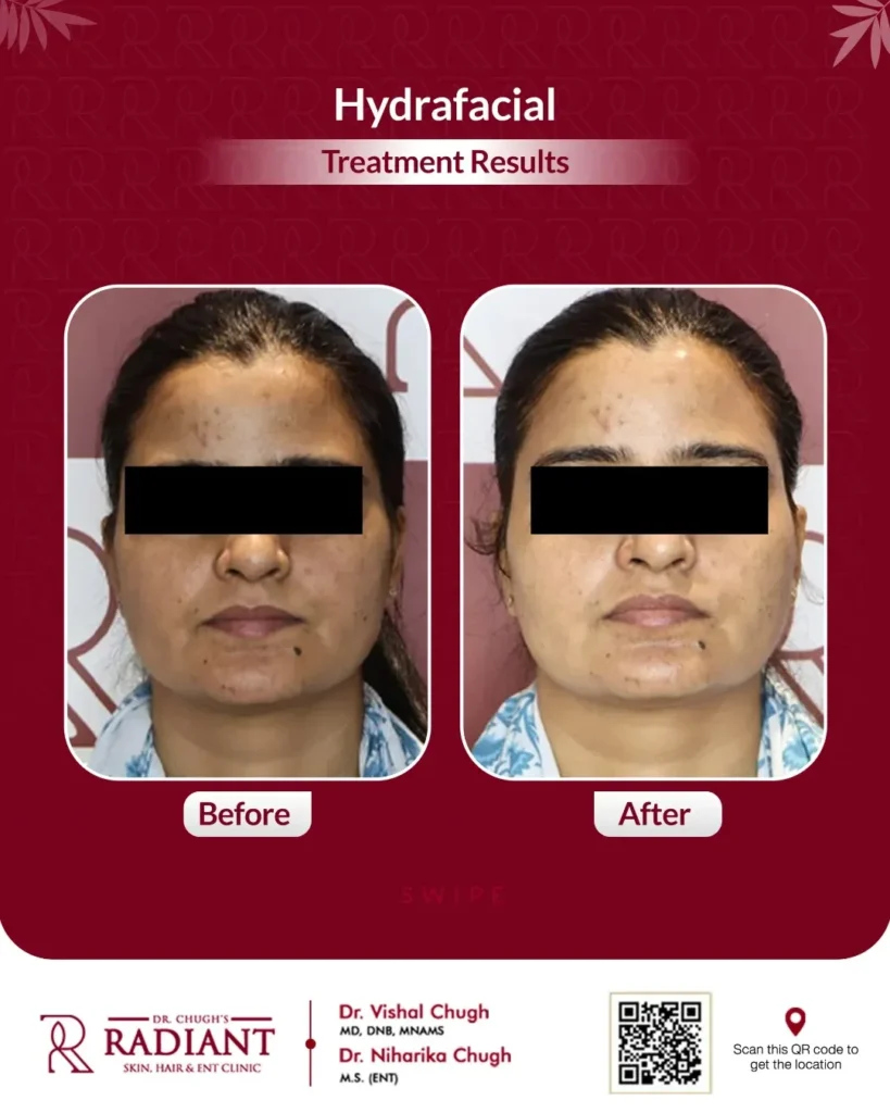 Best Skin Doctor in Jaipur