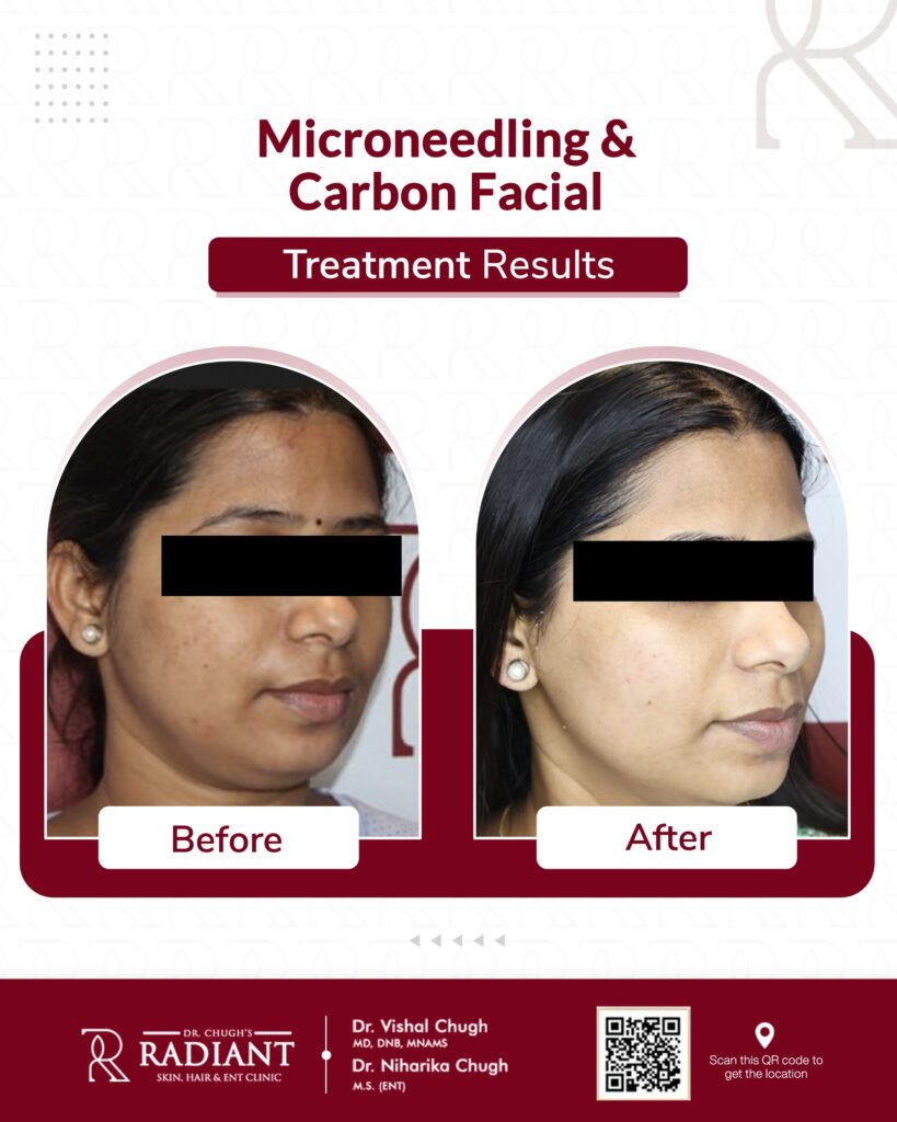 Best Skin Doctor in Jaipur