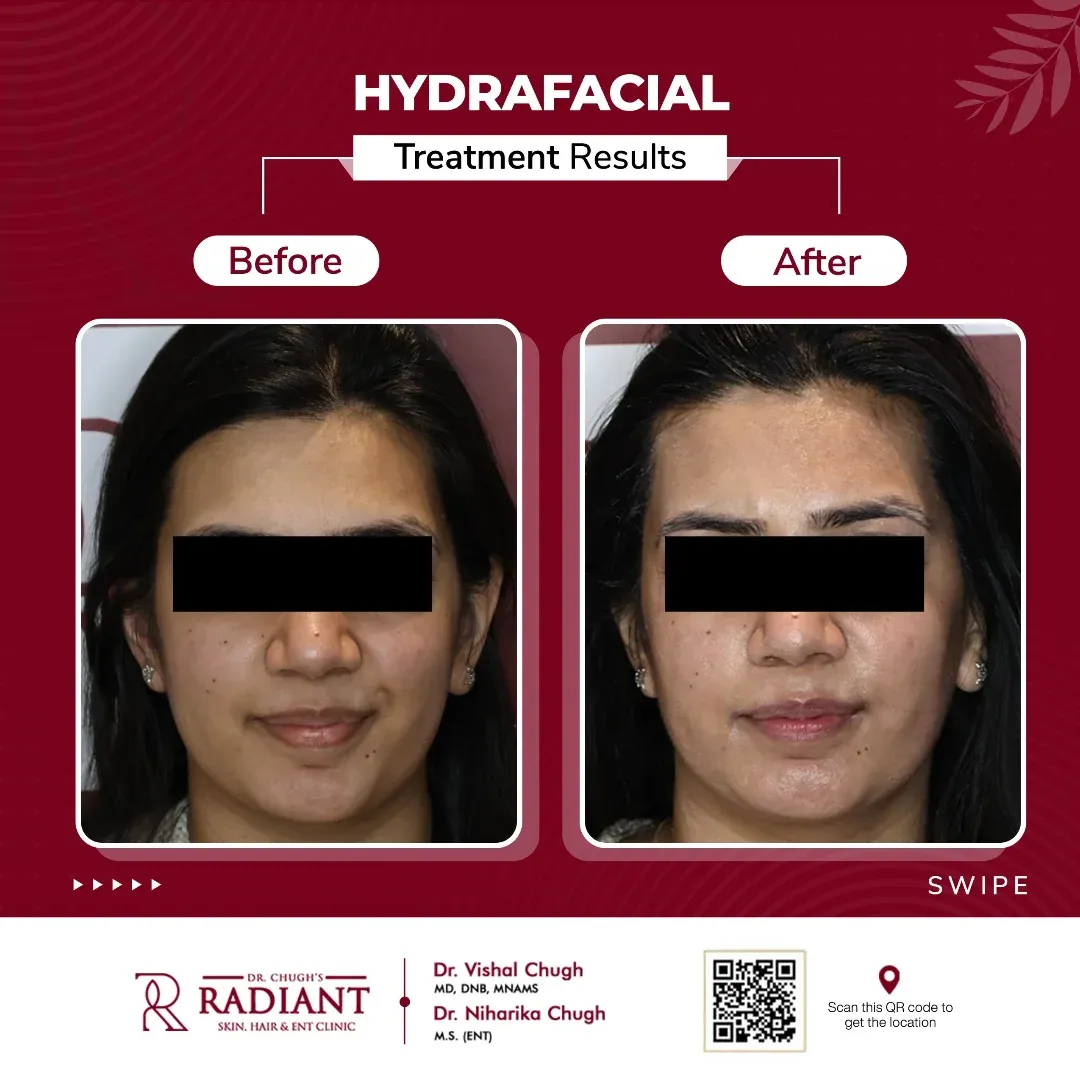 Best Skin Doctor in Jaipur