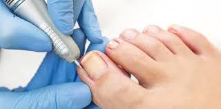 Toenail Surgery in Jaipur