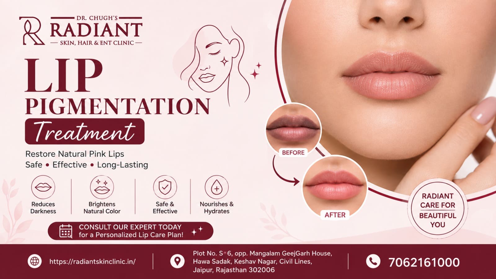 lip pigmentation