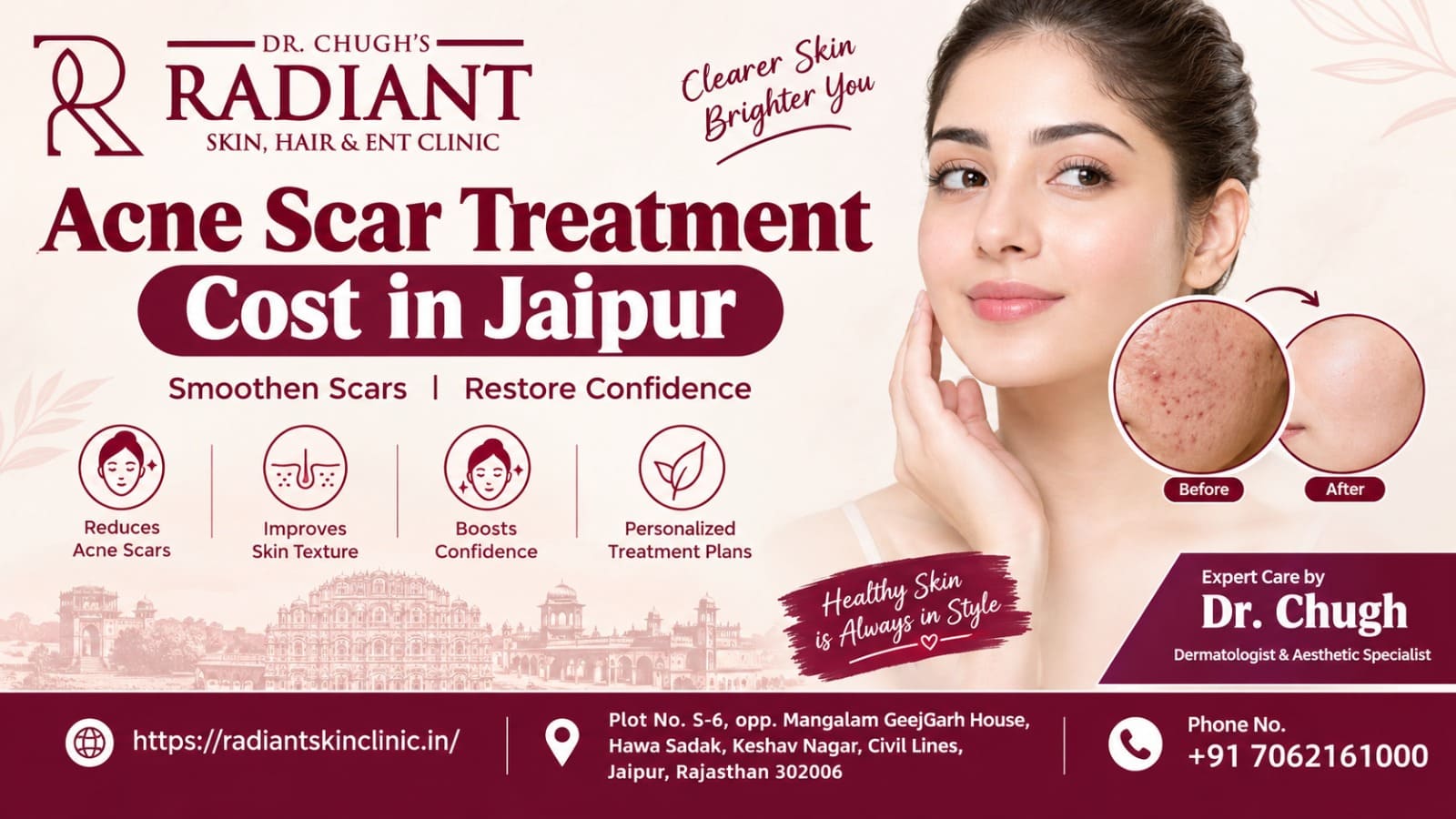 acne scar treatment cost