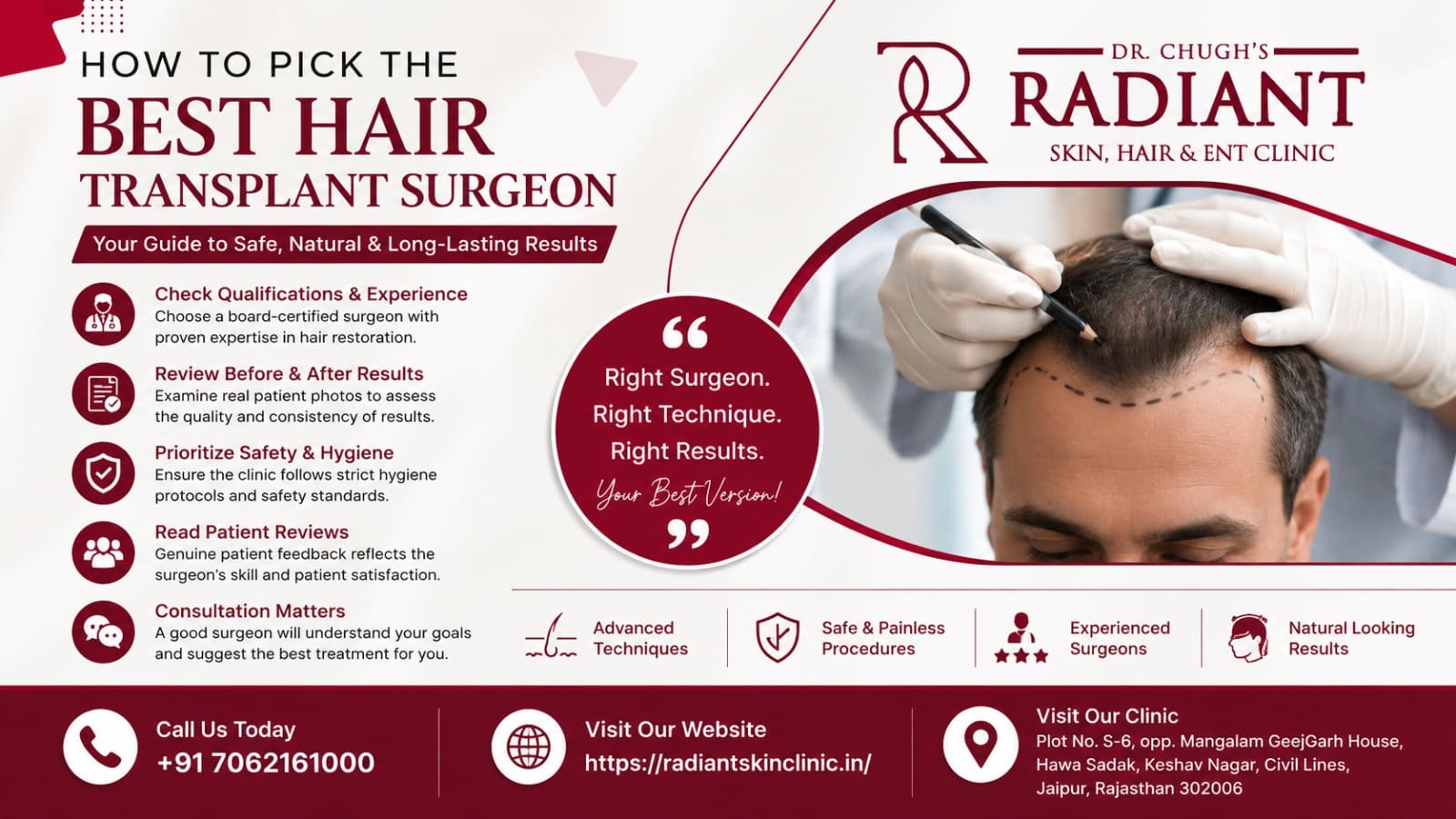 best hair transplant surgeon