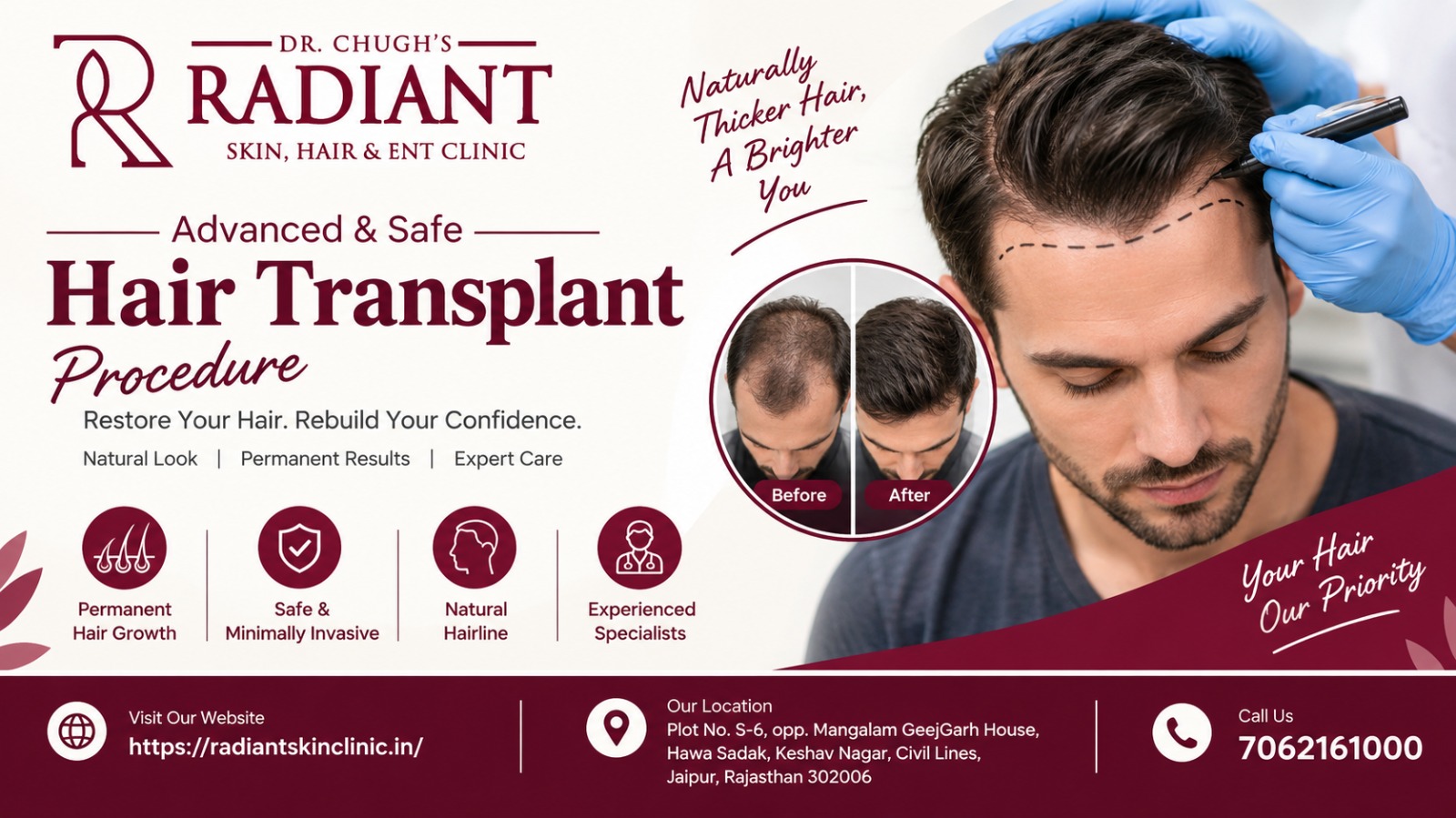 Hair Transplant Procedure